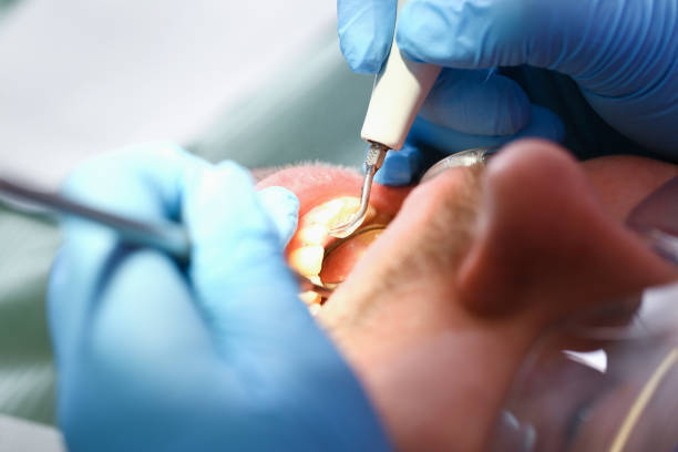 Professional Emergency Dental Service in DE