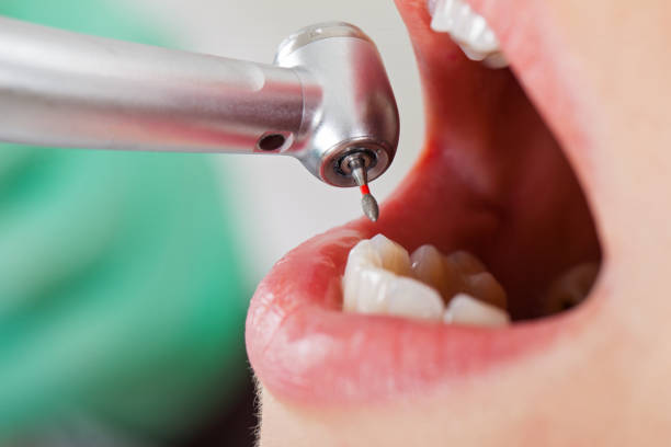 Best Emergency Denture Repair in Brooksi, DE